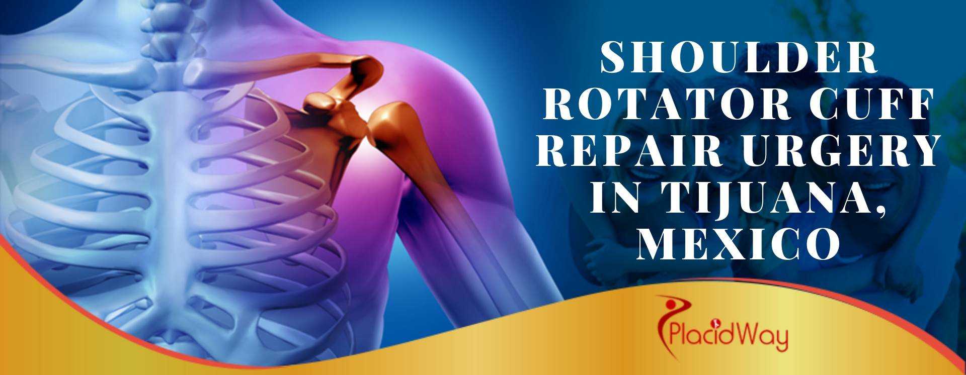 Shoulder Rotator Cuff Repair urgery in Tijuana, Mexico